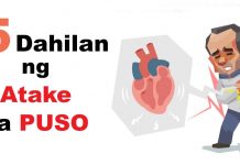 5 Dahilan ng Atake sa Puso Dahilan ng atake sa puso